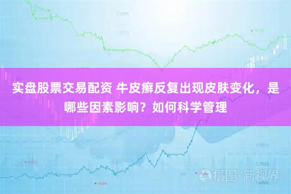 实盘股票交易配资 牛皮癣反复出现皮肤变化，是哪些因素影响？如何科学管理